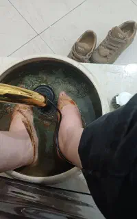 فیشیال تخصصی اسکالپ سر وسم زدایی بدن از طریق پا