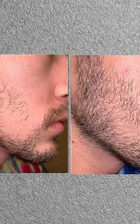 دیگه با تیغ نزن