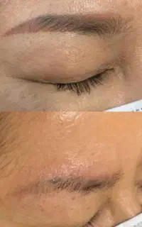 تاتوی قدیمی، خاطره‌ای که وقتِ پاک شدنش رسیده