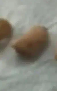 سه عدد سمعک سالم