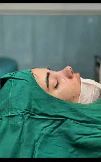 عمل بینی ۳۰ میلیون