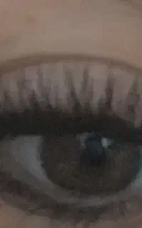کاشت مژه