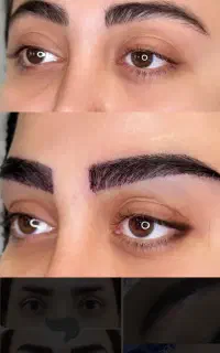 کاشت ابرو