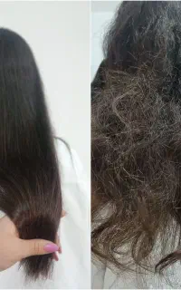 پکیج الماس موخوره گیری الماس بدون کوتاهی مو