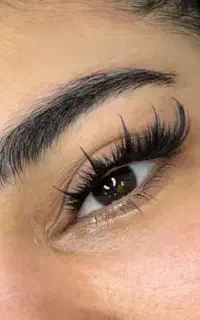 کاشت مژه