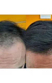 قطع ریزش و رویش