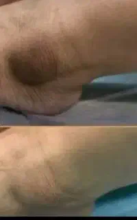 معجزه کرم تایلندی ضمانتی صدرصد مریم محمدی