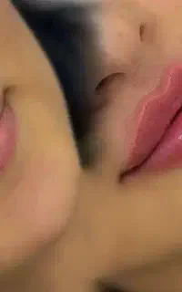 خدمات تخصصی ژل و بوتاکس برای آقایون و خانم ها