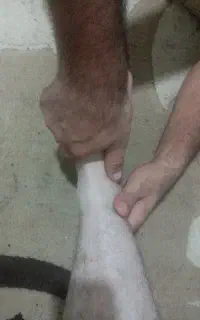 شکسته بند، رگ گیر و شکسته بندی