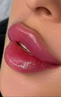 کلینیک تخصصی نخ کلاژن لیفت ژل بوتاکس فیلربادی مزو