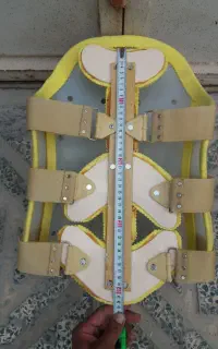 کمربند TLSO