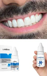 سفیدکننده دندان مدلSmilePro/سفیدی فوق العاده/فوری