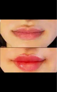 آموزش وخدمات پیرسینگ/میکرودرمال/ژل وبوتاکس