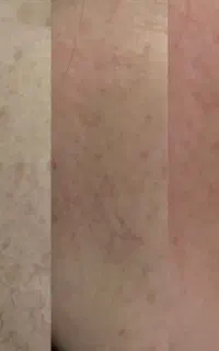 PRPمعجزه جوانسازی