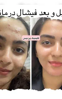 پاکسازی و فیشال تخصصی درمانی