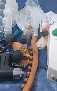 حجامت،بادکش درمانی وماساژکاملابهداشتی استریل