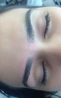 تخفیف ویژه خدمات تخصصی اصلاح صورت و ابرو