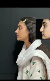فک صورت زیبایی ۳۸ میلیون