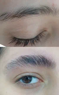 لیفت ابرو و مژه