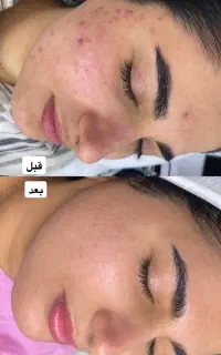 تخفیف فیشال تخصصی