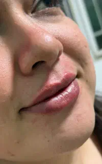 استخدام