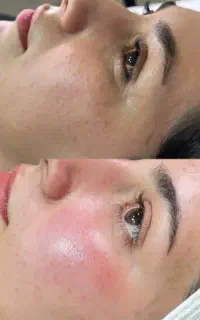 تخفیفات 50%پاکسازی پوست، بافت مو ،لیفت ابرو