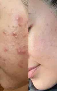 صابون برنج