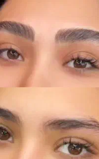 فیبروز ابرو