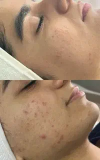 فقط و فقط هزینه مواد