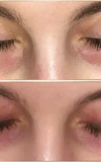 مژه و ابروتو احیا کن بدون کاشت