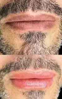رفع تیرگی لب آقایون