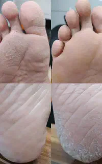 فیشیال .اسپا .مژه