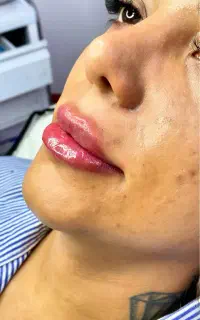 تخفیف ویژه مرداد ماه کلینیک زیبایی