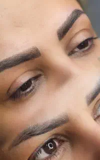 مدل میکروبلیدینگ