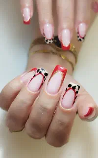 کاشت تخصصی ناخن