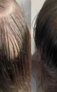 این اقدام اخریشه