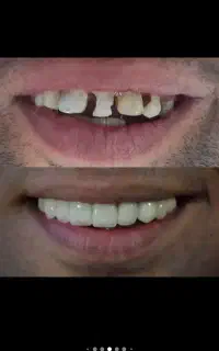 دندانسازی