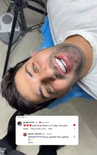 لبخندی جذاب / دنتال الماس/لیرینگ