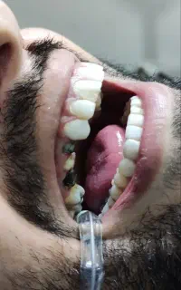 خدمات دندانپزشکی