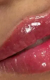 فیلر و بوتاکس لیزر ،هایفو تخصصی،توسط پزشک،وهابی