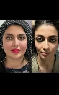 تخفیف ۹۰درصدی ژل باسن و بیکینی هیپ تیپ۹۰تومن