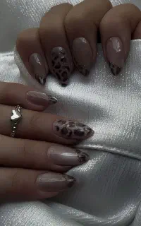کاشت و ترمیم ناخن در(شهرک الوند)