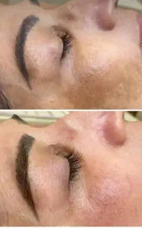 روشن کننده پوست  مطب دکتر