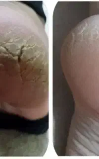 طرف 5روز به نتیجه برسید
