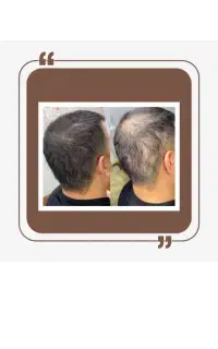 میخای ریش و مو دراری
