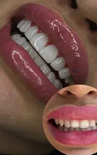 تخفیف ویژه کامپوزیت