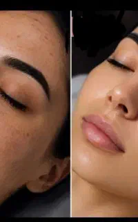 ماسک آرتمیا اصل ترکیه مناسب همه پوست ها