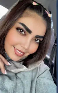 جشنواره کاشت موی سروابروباتراکم بالادرکلینیک معتبر