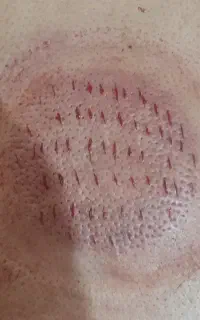حجامت عام و خاص