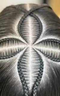 موخوره گیری و بافت مو